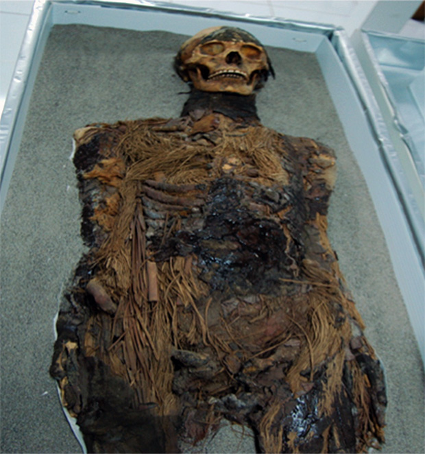 Mummy oozing