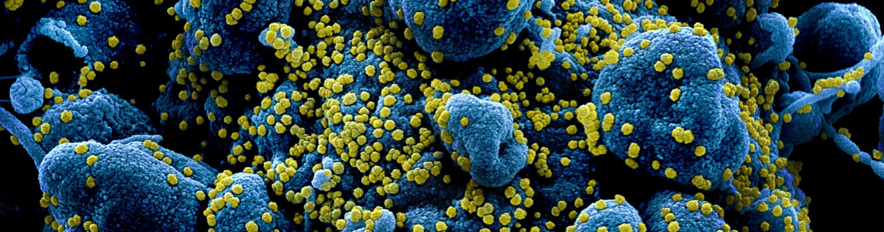 What environmental data are relevant to the study of infectious diseases like COVID-19?